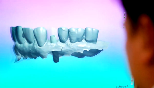 Цифровая стоматология - будущее и настоящее