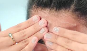 Как лечить и предотвратить сухость кожи зимой